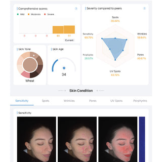 Dr Sebagh Skin Analysis